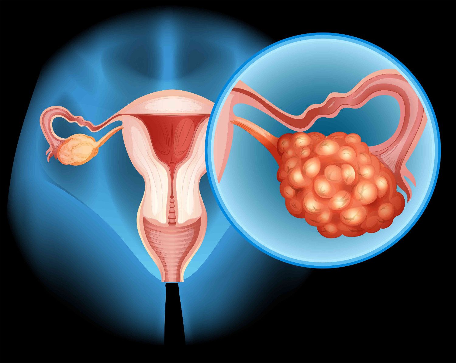 Pelvic Ultrasound Diagnosis