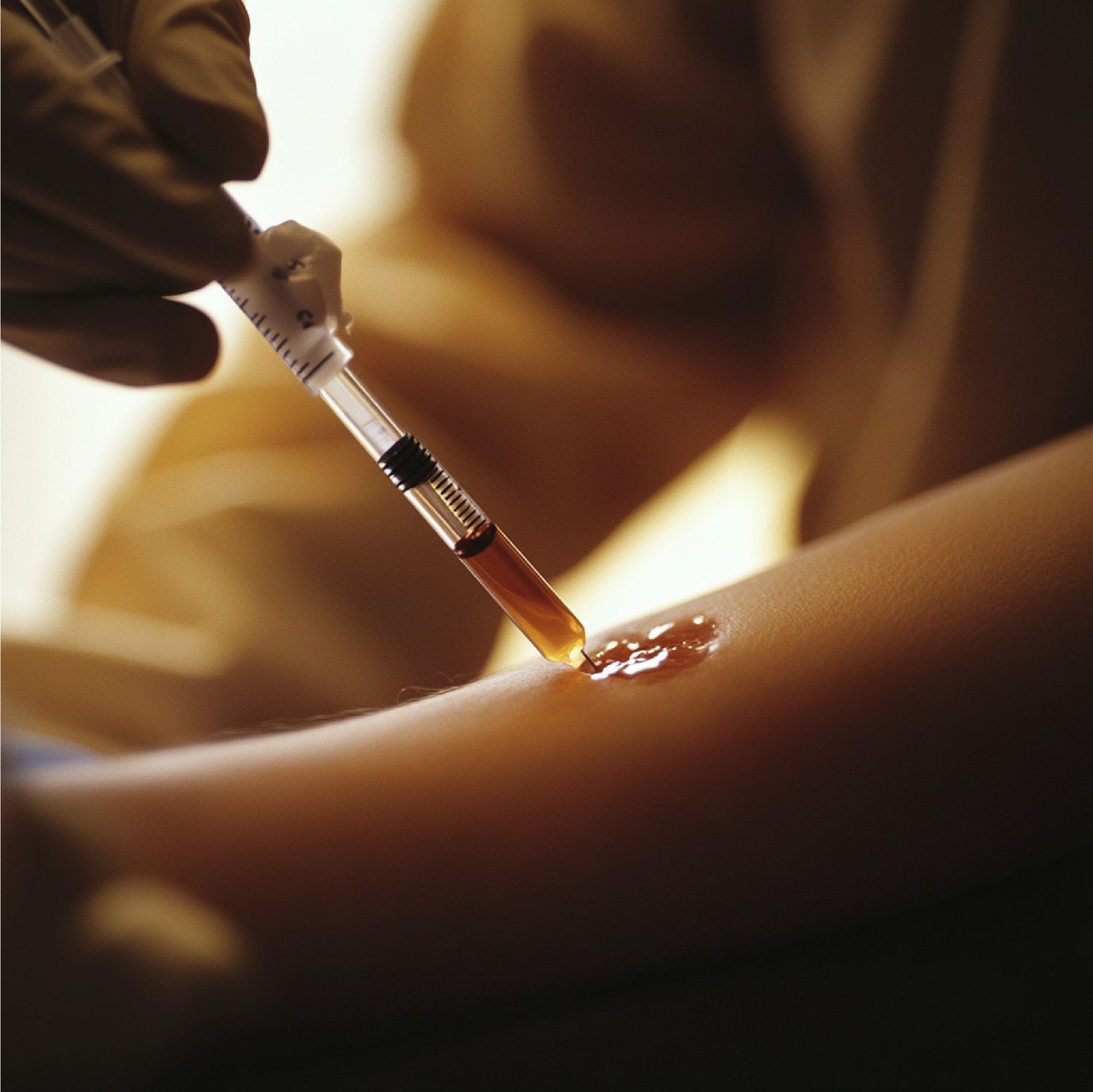 PRP Blood Processing